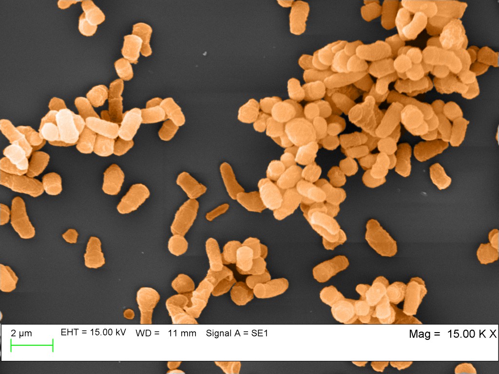A pseudo-colored scanning electron micrograph of R rhodochrous fermentations cells