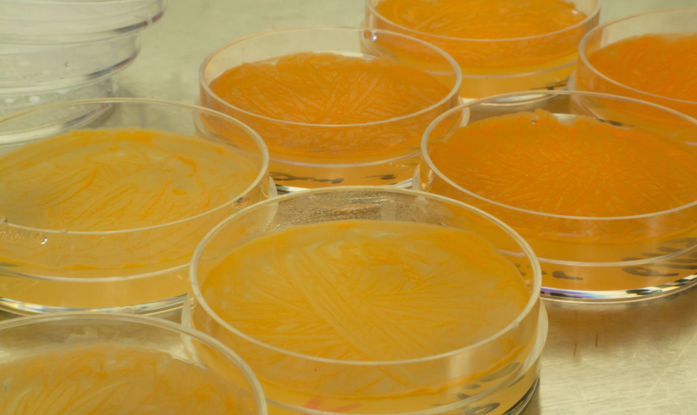 Cells of Rhodococcus rhodochrous strain DAP 96253 grown on induction media Kyle Gabriel Georgia State University